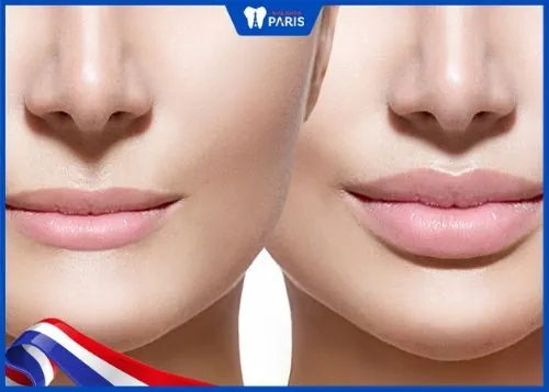 Tại sao có sự khác biệt lớn về thời gian?