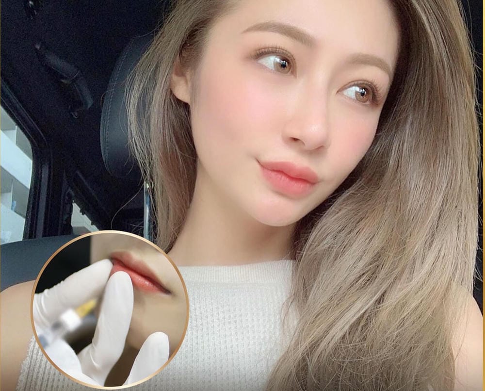 Tiêm môi có nguy cơ gì và dấu hiệu biến chứng cần xử trí gấp?