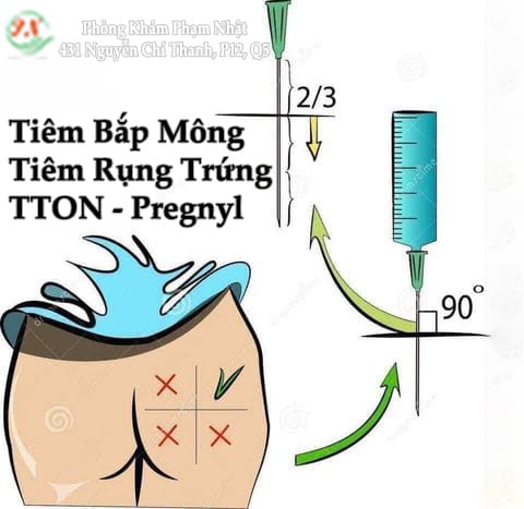 Tiêm mông có an toàn không — rủi ro lớn nhất là gì?