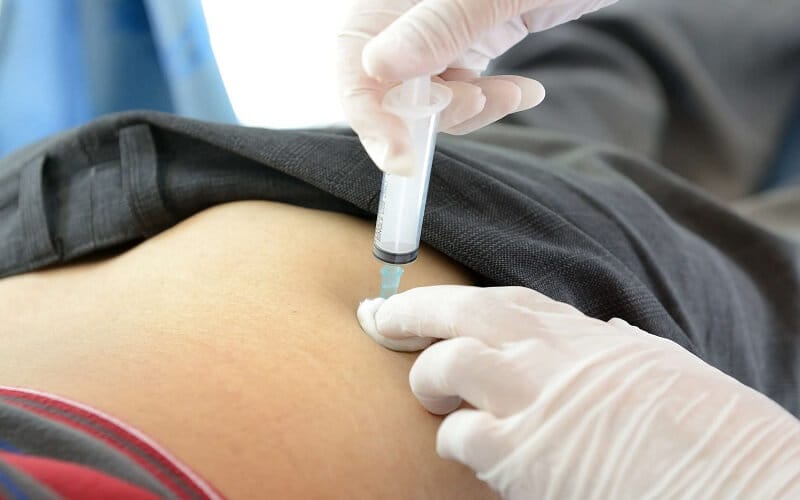 Vì sao một số hiệp hội yêu cầu thay đổi kỹ thuật — có bằng chứng gì gần đây?