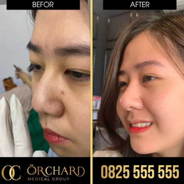 Ngay lúc đó nên làm gì — có thể tự xử lý được không?