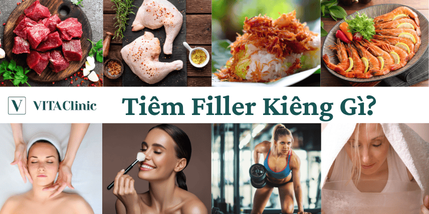 Chăm sóc sau tiêm filler: cần kiêng thực phẩm nào và trong bao lâu?
