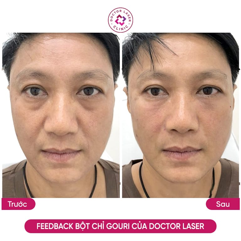 Làm sao chọn nơi tiêm an toàn và giảm rủi ro?