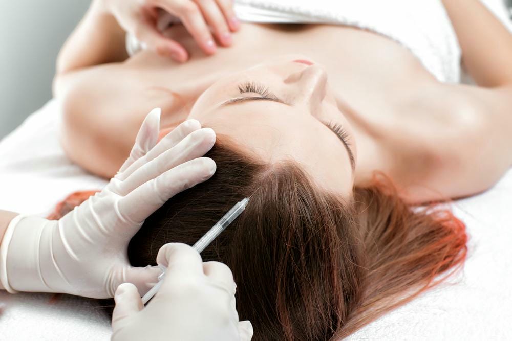 So sánh PRP điều trị rụng tóc, mesotherapy da đầu và exosome — phương pháp nào có bằng chứng tốt hơn?