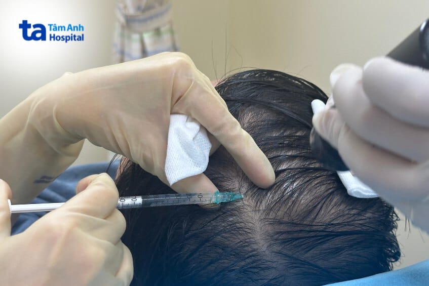 Làm thế nào chăm sóc sau tiêm để tối ưu hóa kết quả?