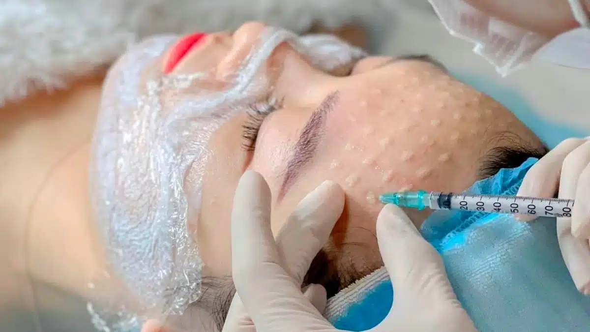 Đối tượng thường phù hợp với tiêm nám