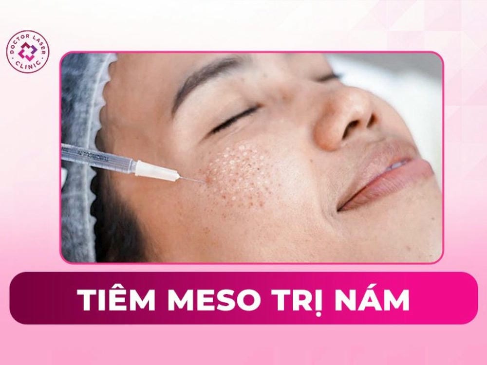 Quy trình điều trị tiêm nám an toàn — thực hiện thế nào để giảm rủi ro?