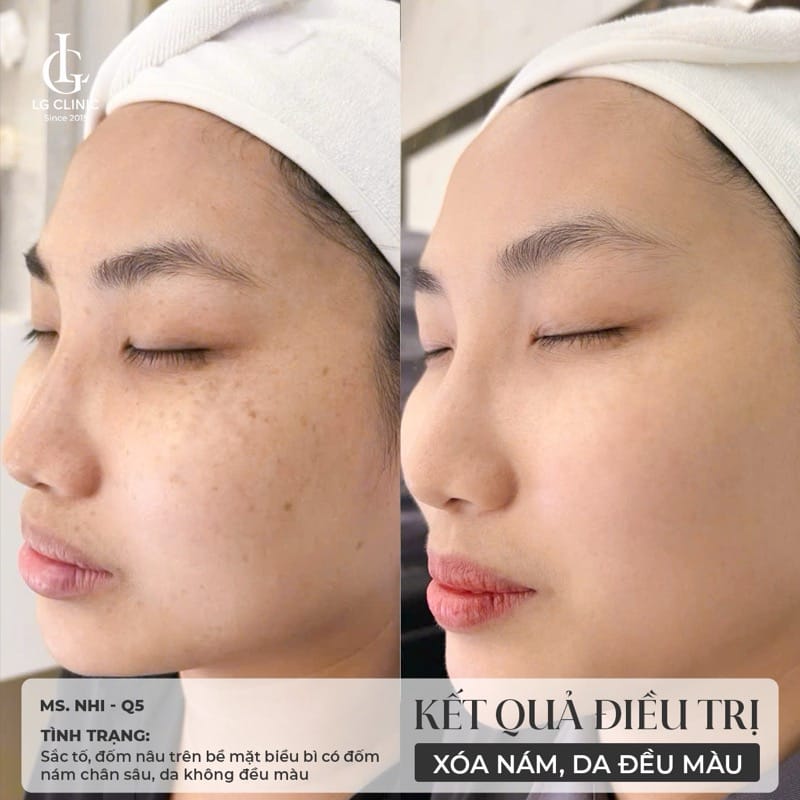 Khi nào không nên tiêm — các chống chỉ định quan trọng?