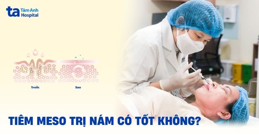 Những câu hỏi thường gặp mà bệnh nhân thường đặt — trả lời ngắn gọn