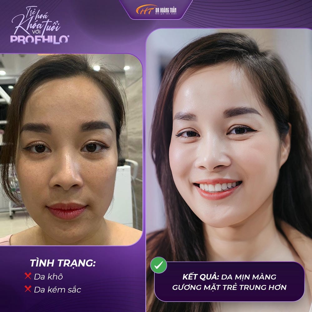 Tại sao lại có khoảng cách 4 tuần giữa hai lần tiêm?