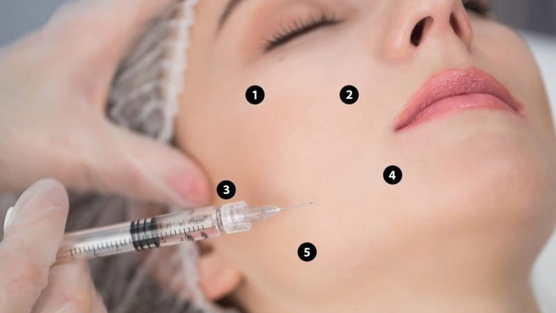 Chuẩn bị trước và chăm sóc sau tiêm