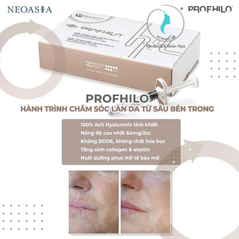 Cách chọn nơi tiêm Profhilo chính hãng, an toàn ở HCM, Hà Nội và Cần Thơ
