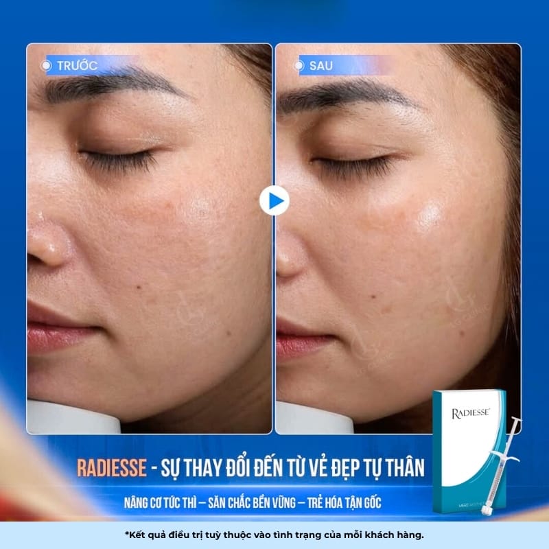 Quy trình chi tiết (mô tả tuần tự)