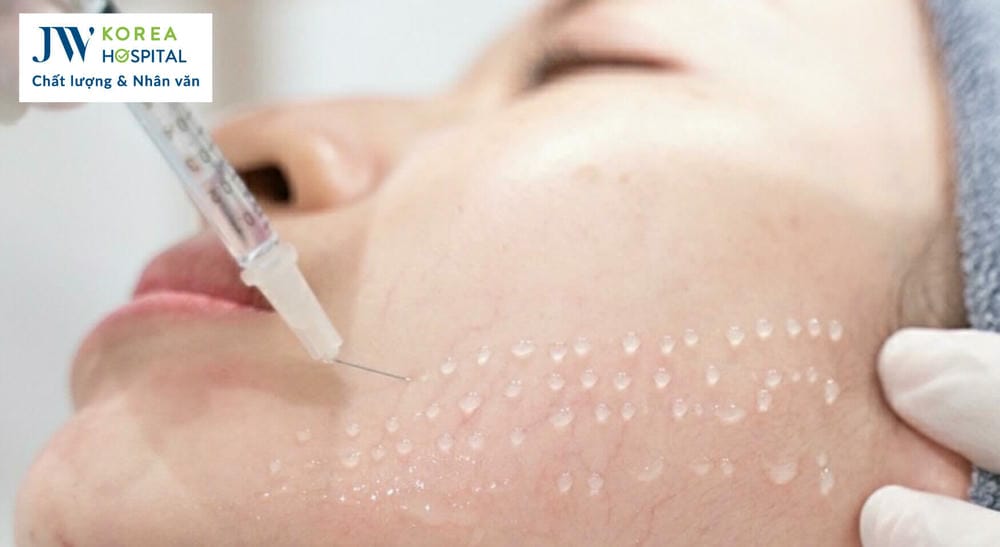 Bước chuẩn bị trước khi tiêm
