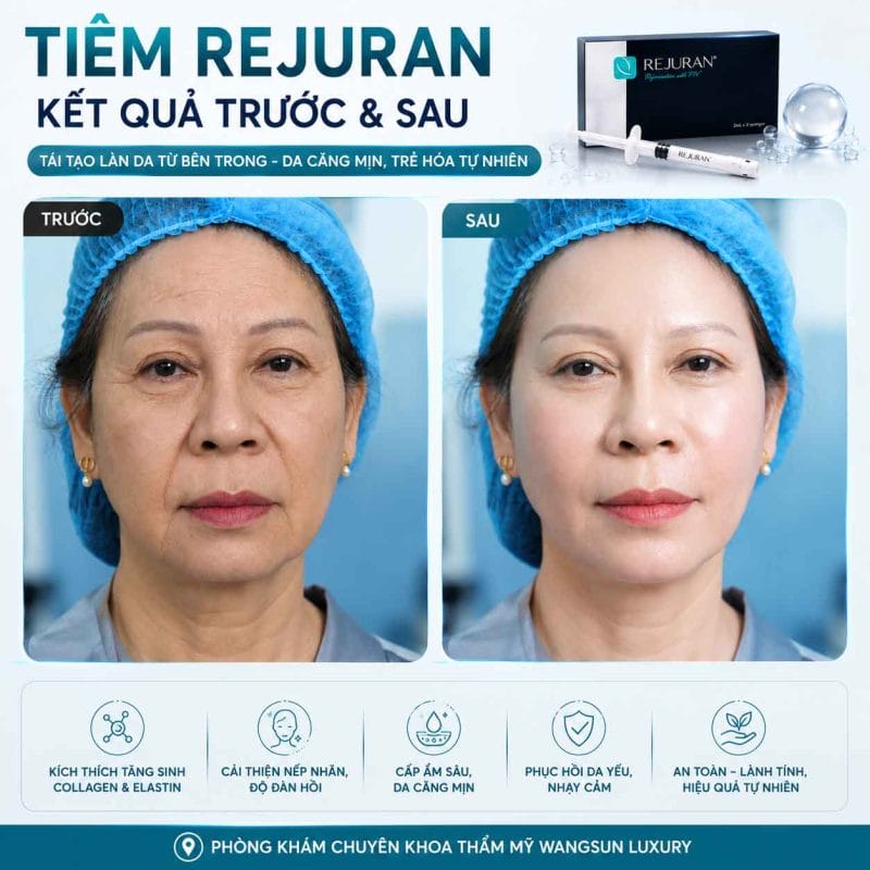 Kỳ vọng thực tế về cải thiện