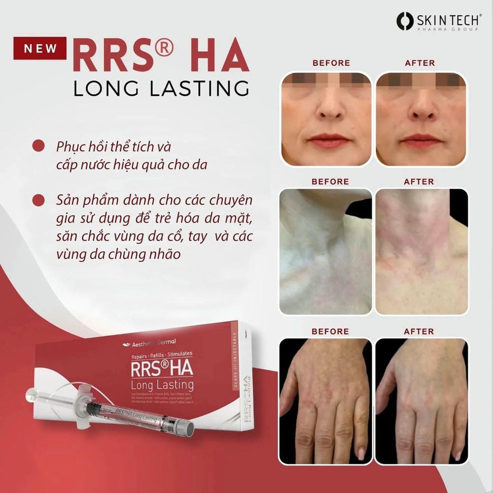 Làm sao để kiểm tra cơ sở có đáng tin cậy khi muốn tiêm RRS?