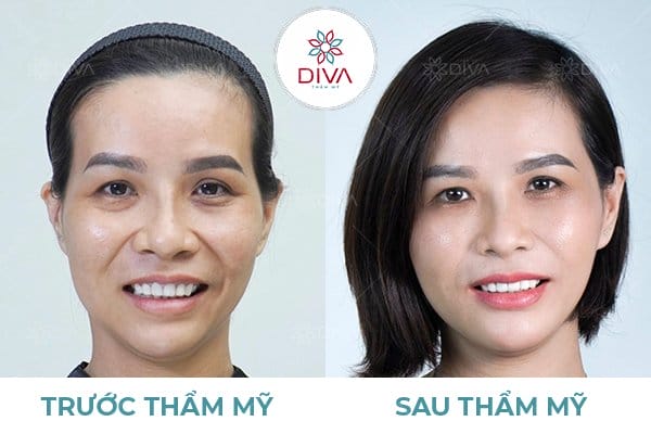 Bằng chứng lâm sàng hiện có nói gì về hiệu quả và an toàn của phương pháp này?