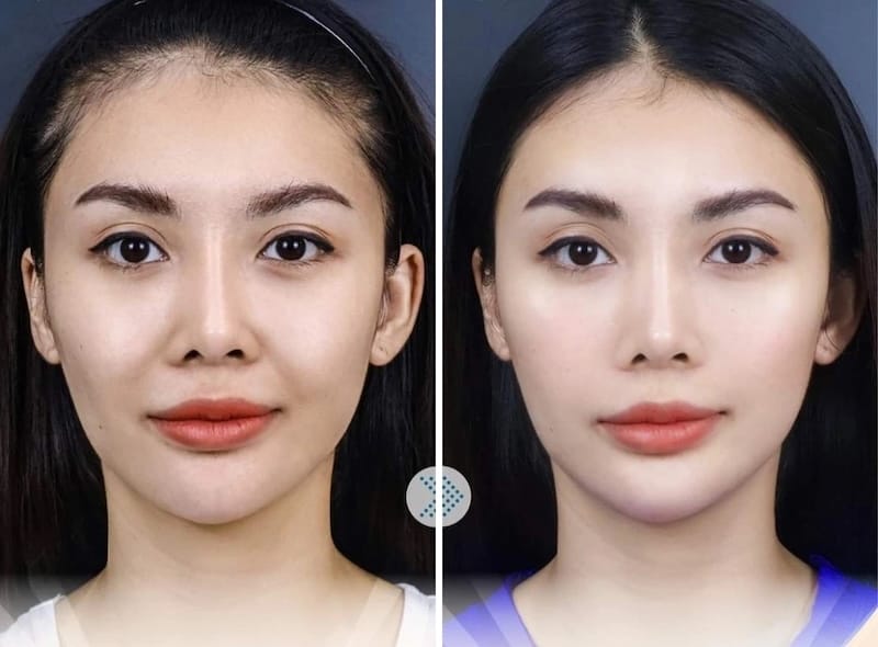 Nên nhìn vào tỉ lệ thực tế