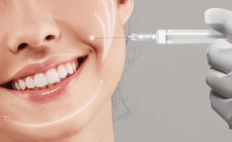 Tiêm rãnh cười có an toàn không — những rủi ro cần biết là gì?