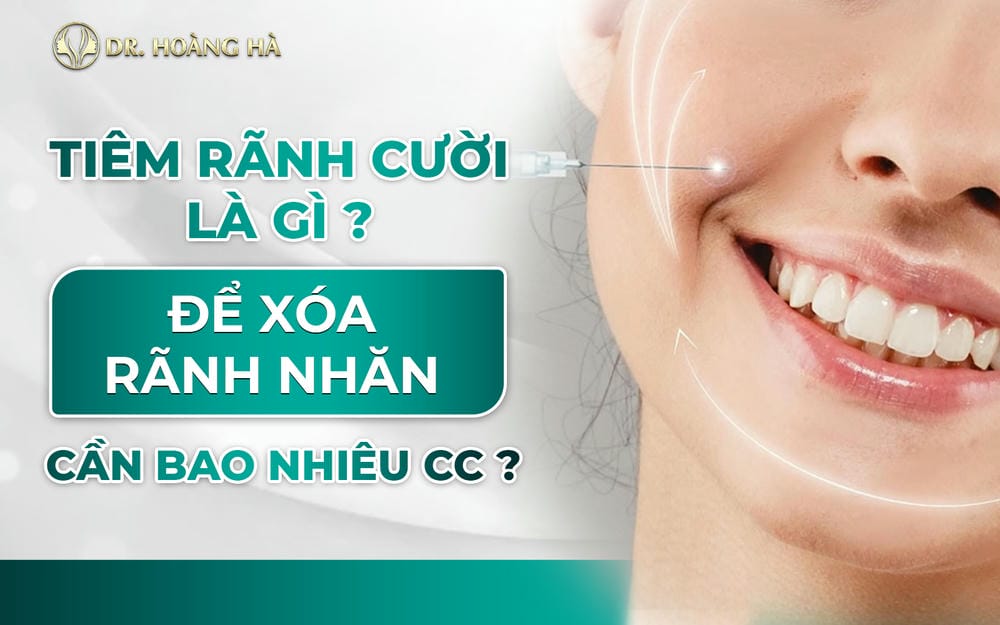 So sánh phương pháp làm mờ rãnh cười (rãnh mũi má) — filler, cấy mỡ, chỉ nâng hay kết hợp?