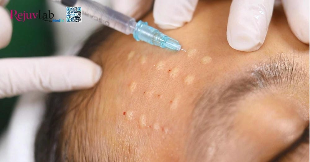 Lời khuyên thực tế trước khi quyết định tiêm