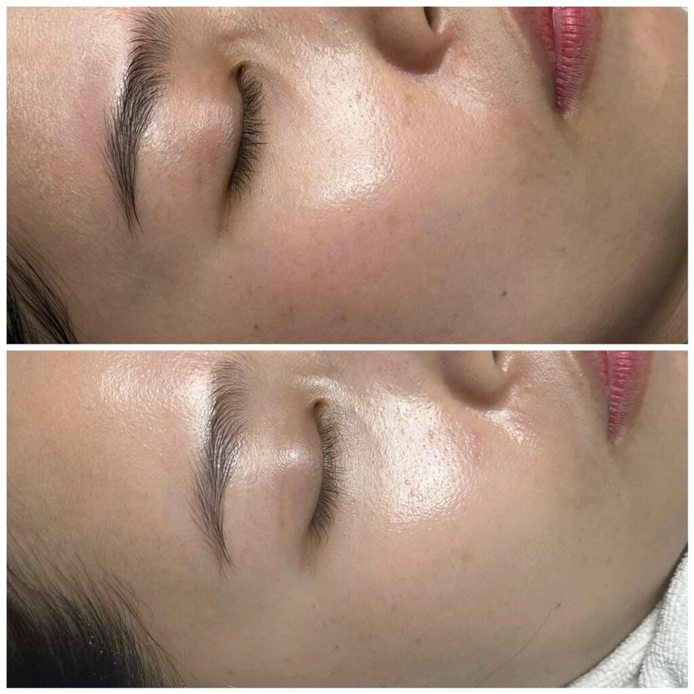 Yếu tố cá nhân ảnh hưởng thời gian và mức độ cải thiện