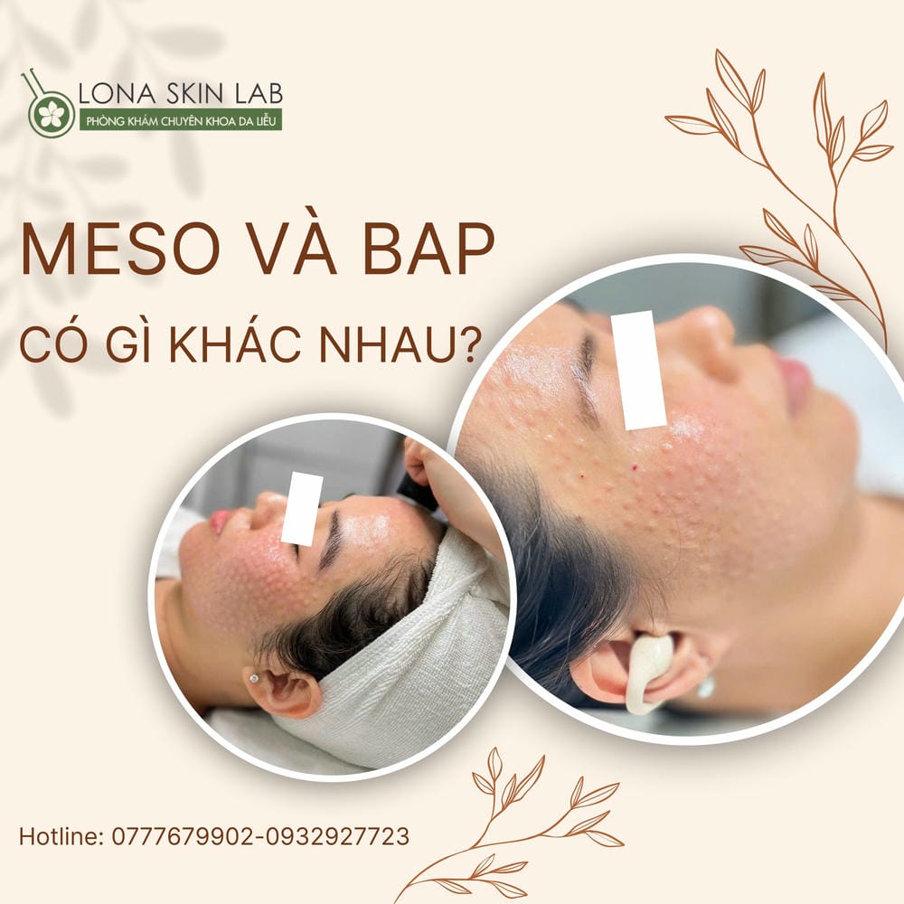 Ai phù hợp và ai không nên tiêm Sunekos?