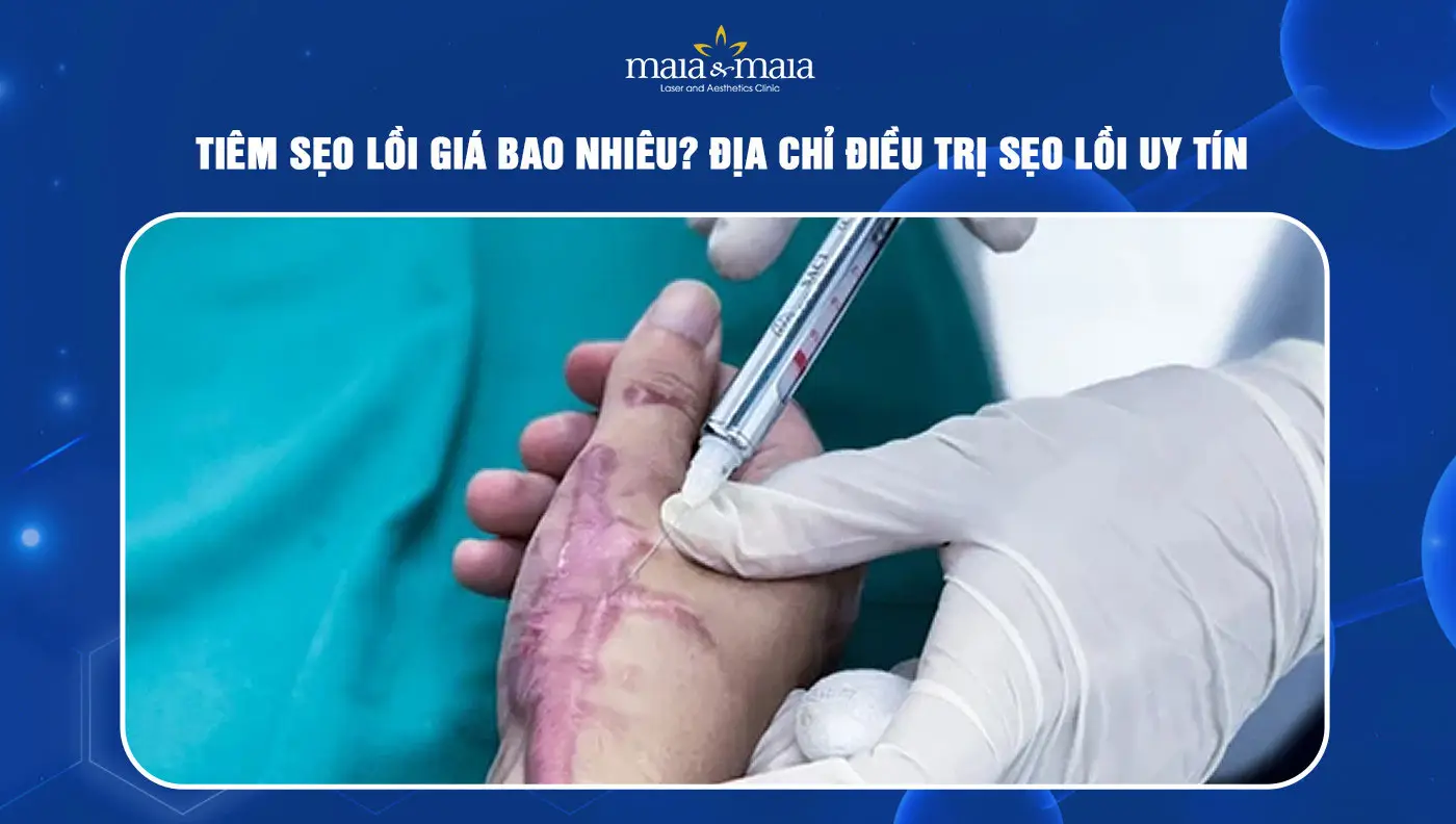 Tiêm sẹo lồi là gì và cơ chế tác dụng của thuốc tiêm như thế nào?