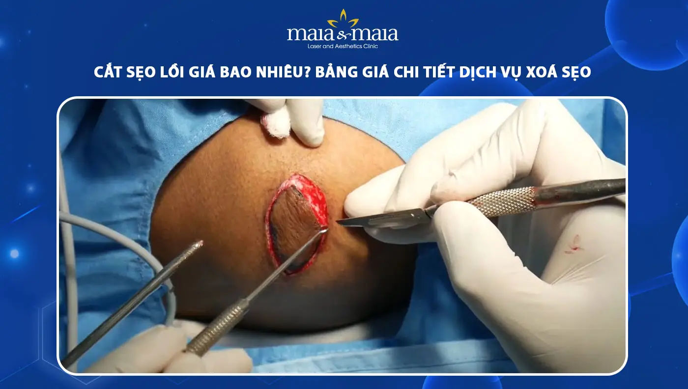 Nguy cơ, tác dụng phụ và rủi ro tiêm sẹo lồi — ai không nên tiêm?