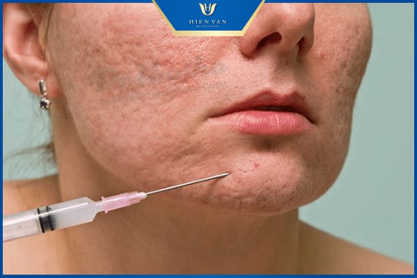 Điều gì có thể mong đợi về kết quả?