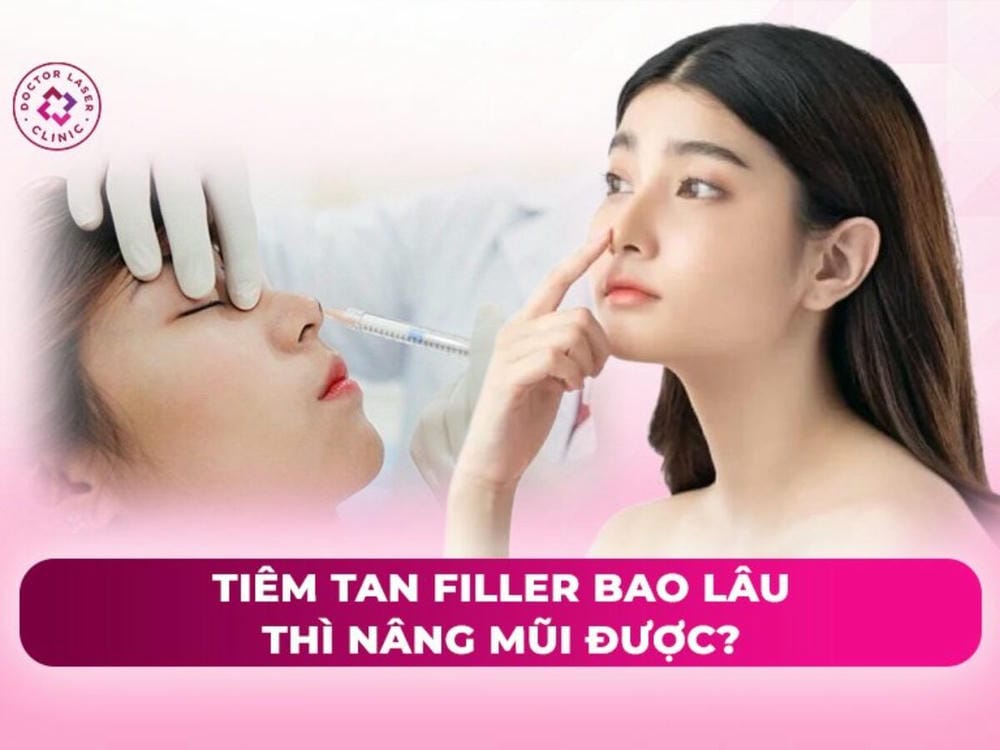 Tiêm tan filler bằng hyaluronidase hoạt động thế nào và ảnh hưởng tới mô mũi?