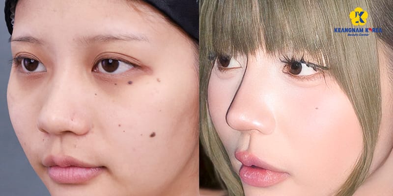 Những câu hỏi bệnh nhân thường gặp
