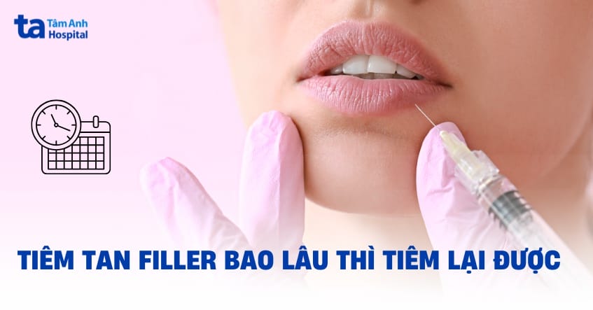 So sánh: Tiêm tan filler ngay hay chờ tự tan — chọn cách nào?