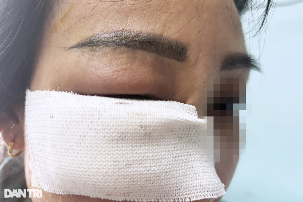 Tại sao mọi người lo "tiêm tan filler có nguy hiểm không" — đâu là rủi ro chính?