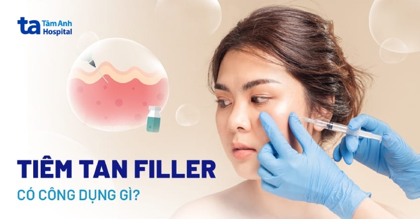 Khi nào cần tiêm tan filler — trường hợp phải làm ngay?