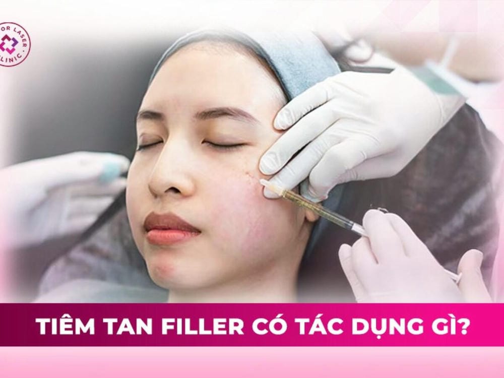 Rủi ro, tác dụng phụ và chống chỉ định khi tiêm tan filler
