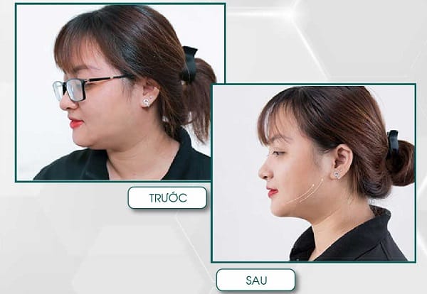 Bằng chứng lâm sàng và kỳ vọng thực tế — kết quả có bền vững?