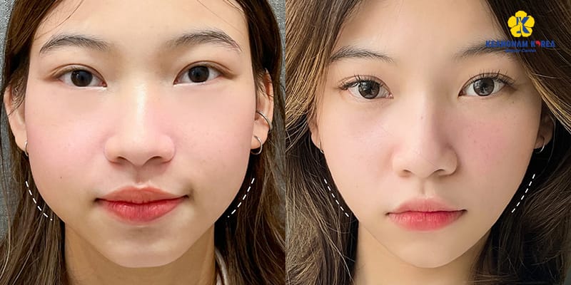 Khi nào nên đánh giá kết quả cuối cùng và có cần làm thêm?