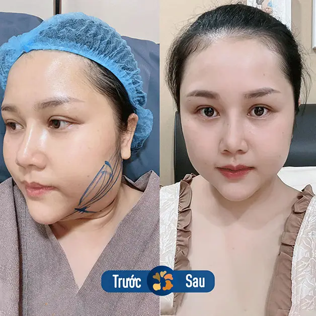 3) Có thể kết hợp với các liệu pháp khác không?