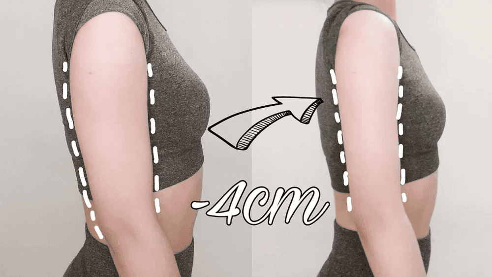 Tiêm thon gọn bắp tay áp dụng phương pháp nào và tiêm botox bắp tay, tiêm tan mỡ bắp tay hoạt động ra sao?