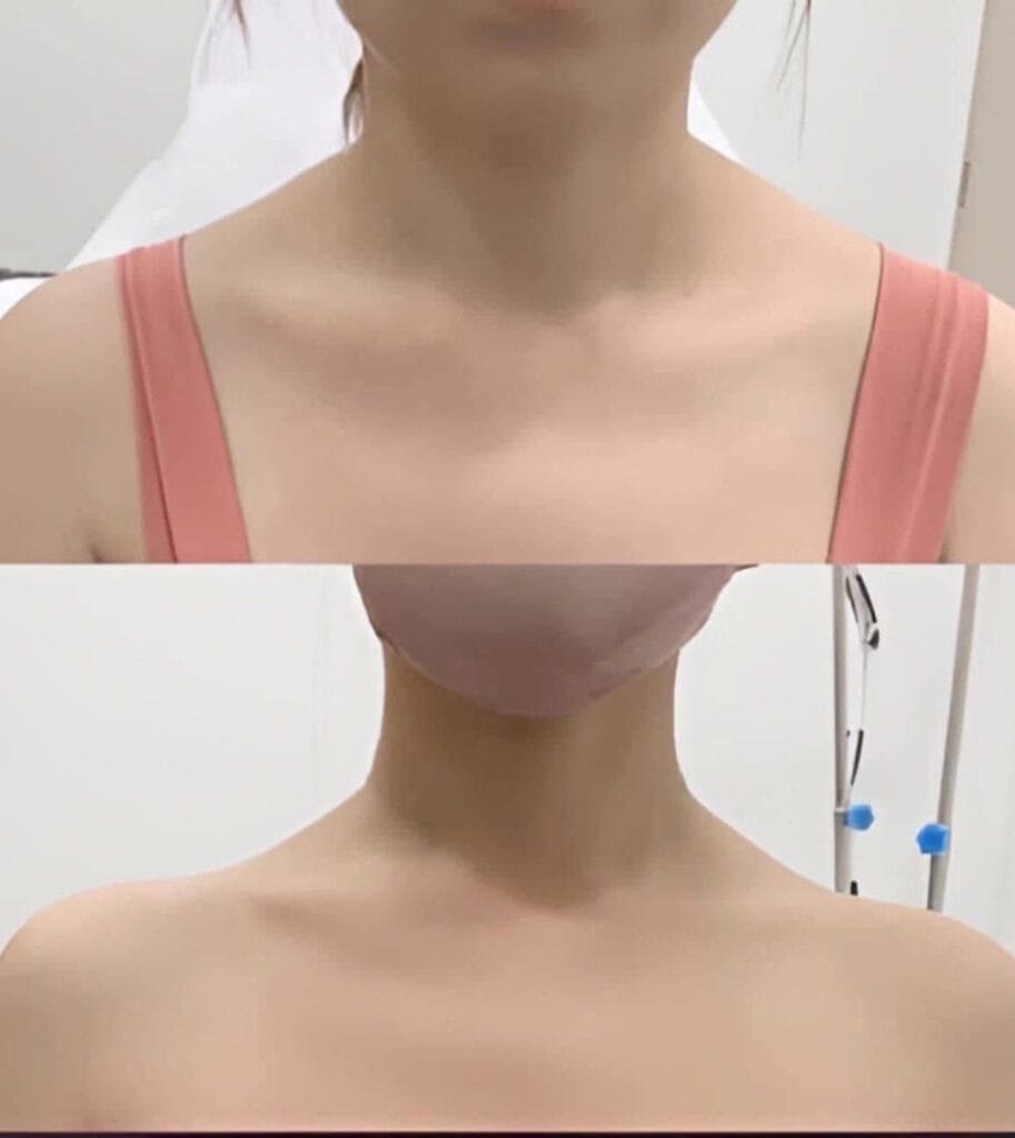 Nếu đang cân nhắc: những câu hỏi nên hỏi bác sĩ trước khi tiêm?