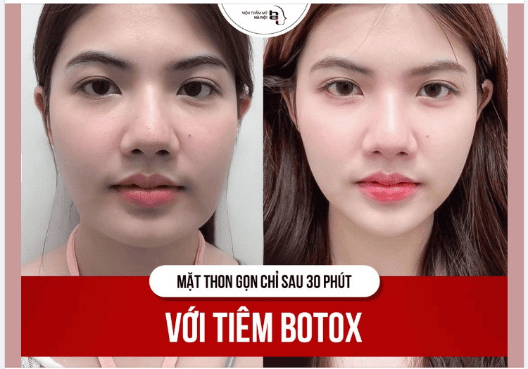 Bằng chứng lâm sàng tóm tắt — có đủ tin cậy để chọn phương pháp này không?