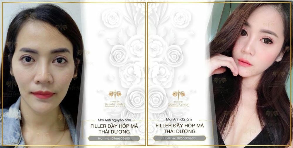 Bằng chứng lâm sàng và hướng dẫn an toàn