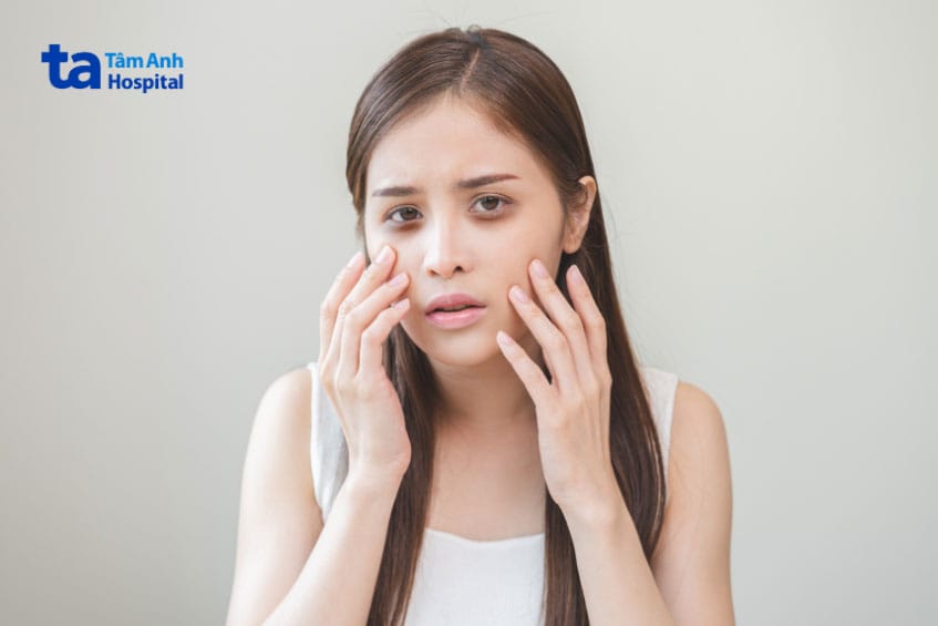 Chăm sóc sau tiêm và những lưu ý để giảm rủi ro