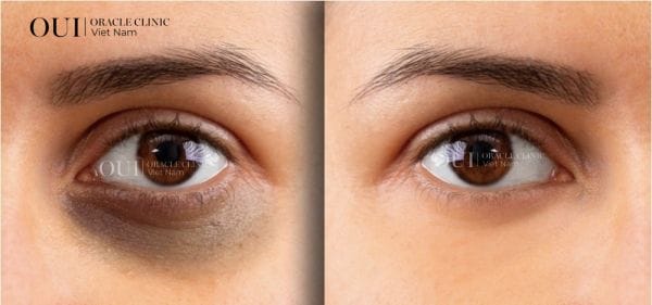 Khi nào nên liên hệ bác sĩ ở Lona Skin Lab — và điều gì sẽ được làm tại buổi tư vấn?