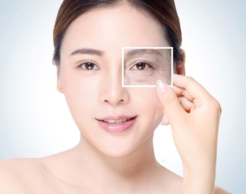 Tiêm tăng sinh có thật sự hiệu quả cho quầng thâm, bọng mắt và rãnh lệ không — so sánh với PRP và filler?