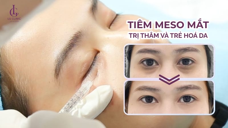 Điểm khác biệt chính — nhanh, bền, rủi ro