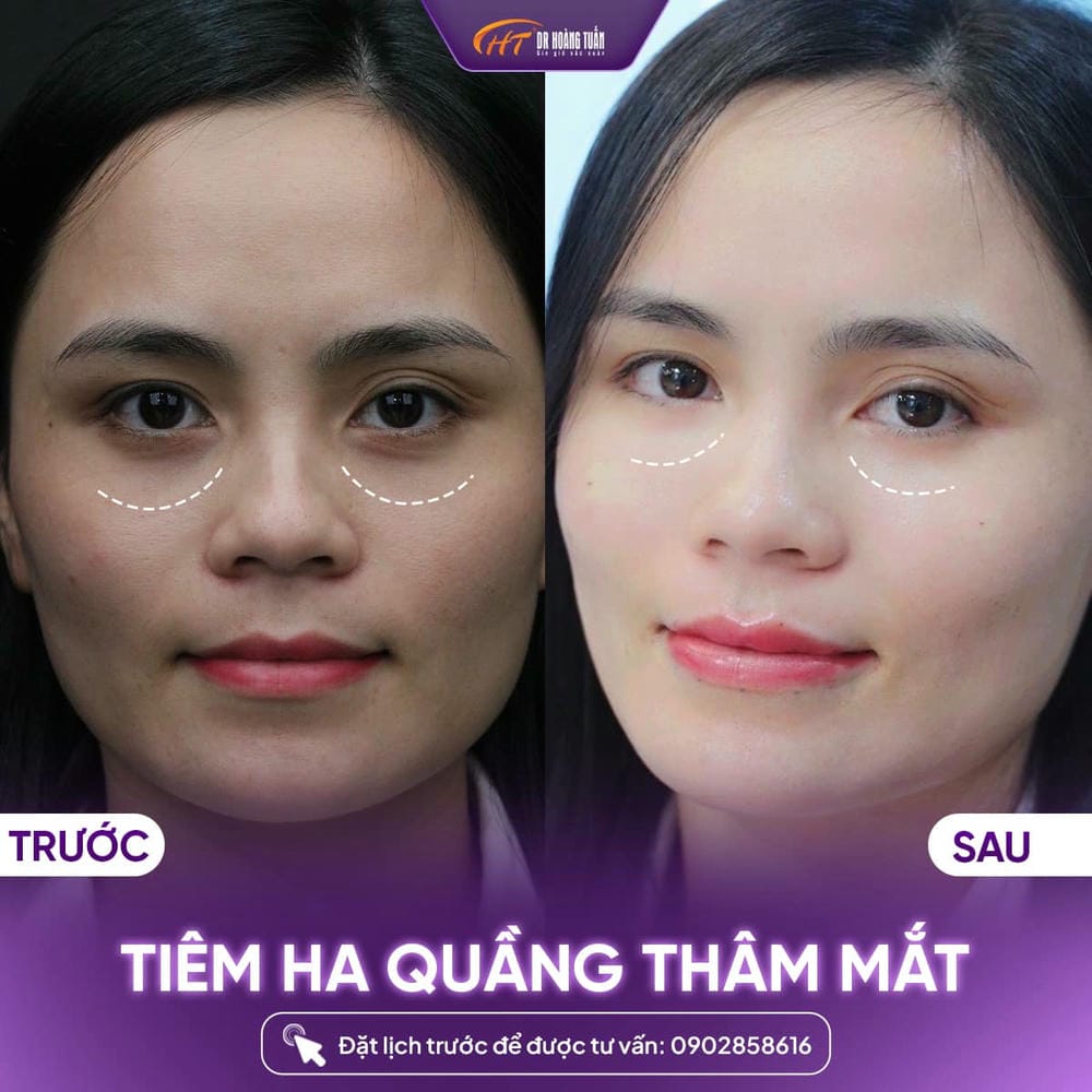 Quy trình cụ thể (mô tả bước theo thứ tự)