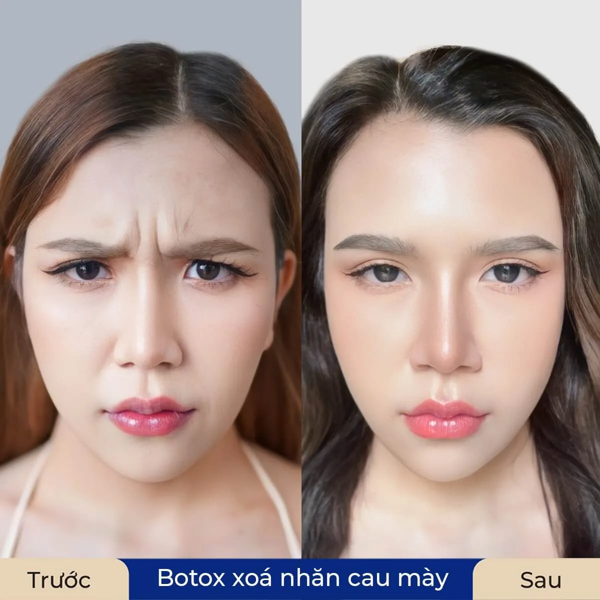 Các thủ thuật kết hợp để đạt kết quả hài hòa hơn là gì?