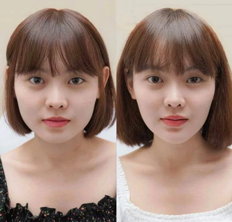 Nếu kết quả không như mong muốn hoặc có biến chứng thì xử trí ra sao?